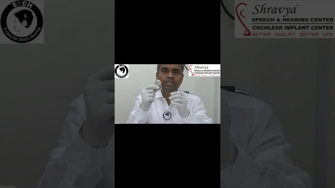 Cochlear Implant, Speech after cochlear implant surgery,Cochlear Implants in Hyderabad, Speech Delay