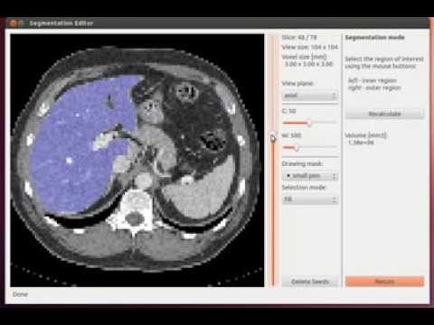 New viewer for Graph-Cut segmentation