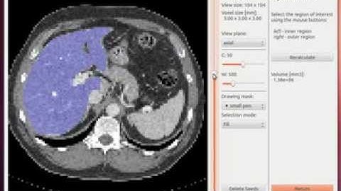 New viewer for Graph-Cut segmentation