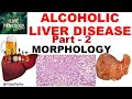 ALCOHOLIC LIVER DISEASE: Part 2. Morphology, Clinical Features & Complications including cirrhosis