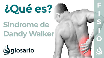 ¿Cómo es el síndrome de Dandy-Walker?