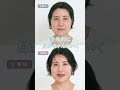 敏感肌のニキビ跡トラブルにはこれ！多色コンシーラーパレット使いこなし術！