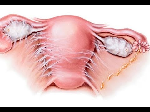 Pictures and Facts About STDs