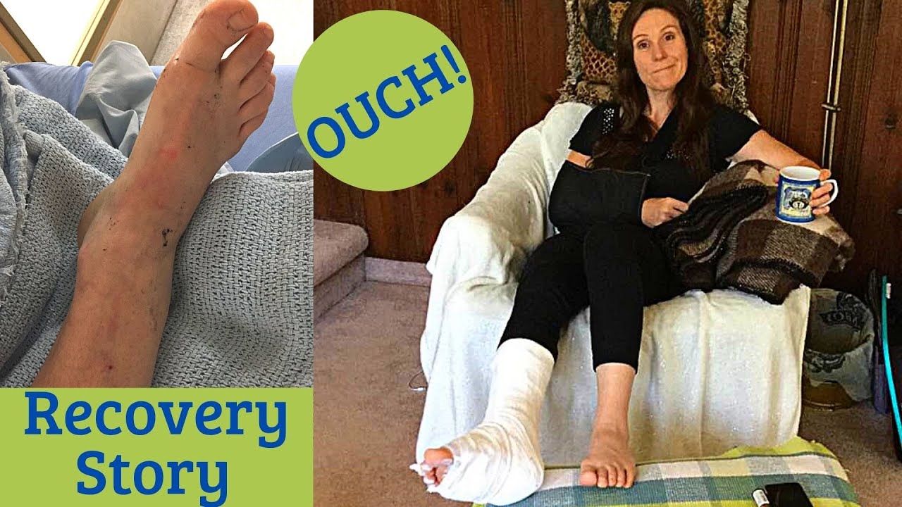 My Recovery from Ankle Surgery and a broken Collarbone - Part 1 (re-edited for copyright)