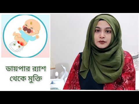 ভিডিও: একটি ডায়াপার জিনি বিন্দু কি?