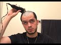 Likemikeyv Head Shave (In Support of FARA)