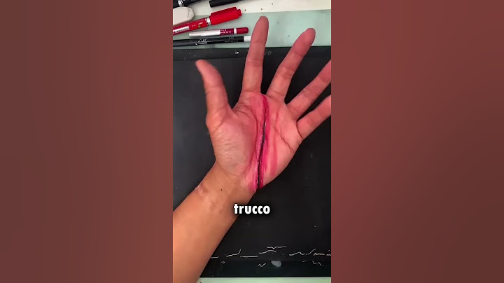 Che cosa è successo alla tua mano