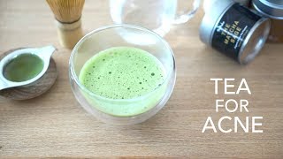 Clear Hormonal Acne with Tea | How to make Matcha