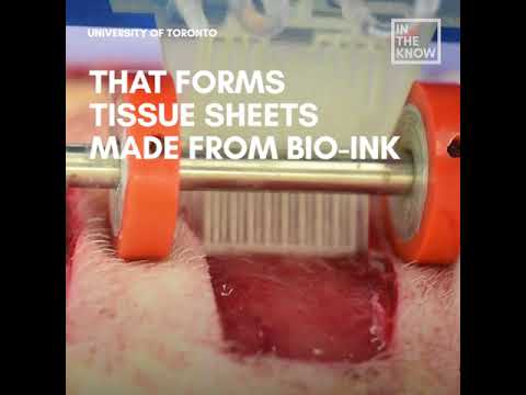 Video: A Portable 3D Skin Printer Can Help Heal Deep Wounds