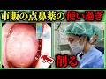【徹底解説】市販の点鼻薬を毎日使うと鼻が詰まる！？知らないと怖い薬剤性鼻炎の正体とは
