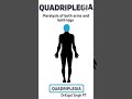 "Classifying Paralysis: Types and Characteristic s#NeuroHealth#SpinalCordInjury#DisabilityAwareness