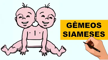 O que ocorre durante a formação dos gêmeos siameses?