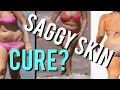 SAGGY BODY SKIN CURE? BYE BYE BATWINGS & SAGGY TUMMY & THGHS! LET'S FIRM UP OUR SKIN TOGETHER!