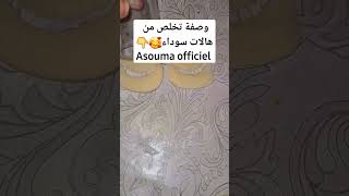 تخلص من سواد تحت لعين??