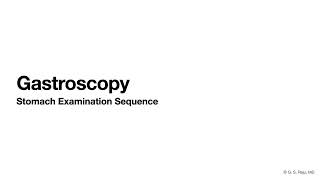 Gastroscopy-Stomach Exam-Steps