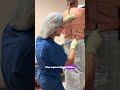 Bra Line Back Lift Markings: How Excess Back Skin Is Removed | Dr. Pautler