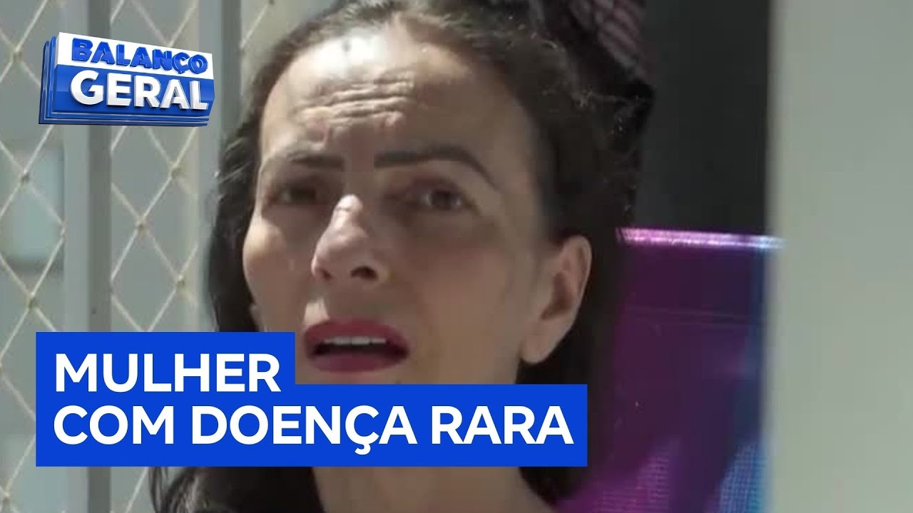 Família busca tratamento adequado para terapeuta com doença rara