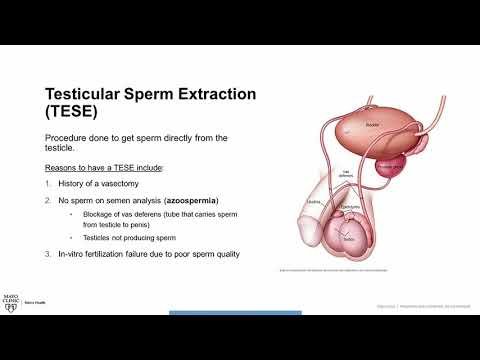 Testicular Sperm Extraction (TESE) Procedure Overview