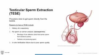 Testicular Sperm Extraction (TESE) Procedure- Overview