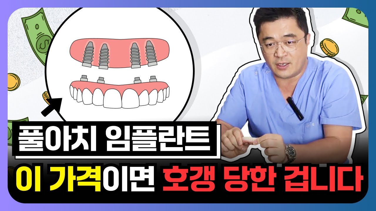 풀아치 임플란트, 평균 비용 의사가 속 시원하게 공개하도록 하겠습니다. 올온엑스. all on x