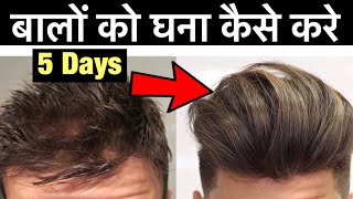 बालों को घना कैसे करे | Natural Way to Stop Hair Fall | Regrow Hair Fast, How to Get Thicker Hair screenshot 5