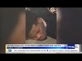 Mom accuses Mobile police of excessive force in teen's arrest