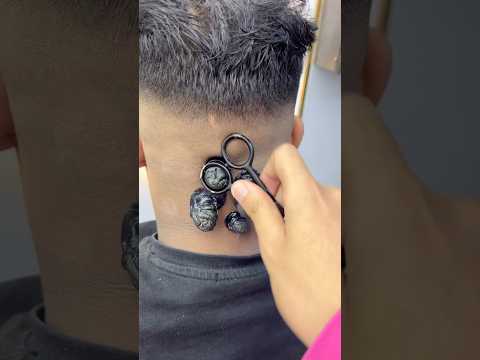 ازالة الحباية المتسلطنة من القفا       