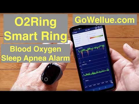 Wellue O2Ring™ Smart Ring Dynamic HR, Blood Oxygen, Sleep Apnea, Vibrate Alarm: Unboxing & Review