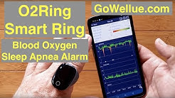 Wellue O2Ring™ Smart Ring Dynamic HR, Blood Oxygen, Sleep Apnea, Vibrate Alarm: Unboxing and Review