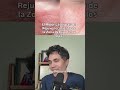 El Mejor Láser para el Rejuvenecimiento de la Zona Debajo de los Ojos