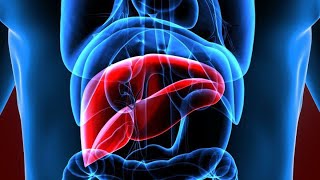 Course Outline for Studying Hepatoma (Hepatocellular Carcinoma)