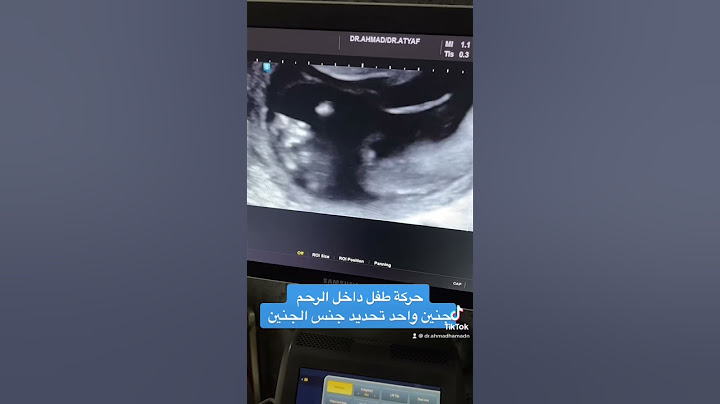 حركة الطفل داخل الرحم تحديد جنس الجنين #الدكتور_أحمد_عدنان_حمدان #تحديد_جنس_المولود