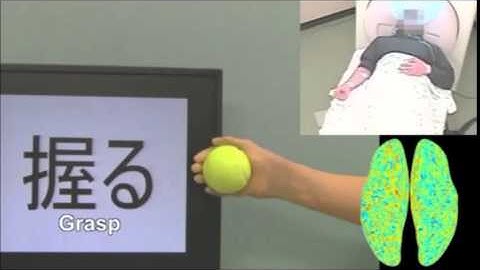 Closed-Loop Control of a Neuroprosthetic Hand by Magnetoencephalographic Signals