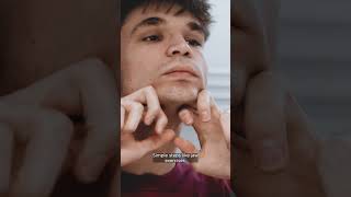 Jaw Pain? Dr. Antonio Explains TMJ!