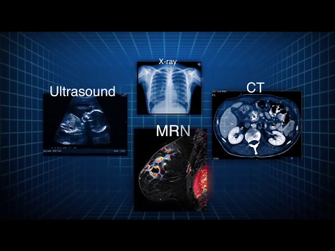 Luciferase-Modified Magnetic Nanoparticles in Medical Imaging 