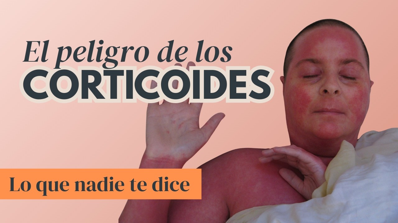Psoriasis: El peligro de los CORTICOIDES que nadie te explica (Efecto Rebote)