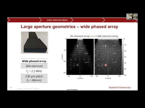 Stanford Radiology: PHIND