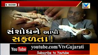Worlds First Successful Telas Bone Operation do by Dr Rajiv Shah of Vadodara | Vtv News screenshot 4