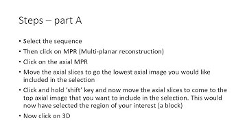 SECTRA PACS 3D-reconstruction of skull and brain