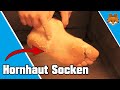 Hornhaut Socken - So einfach Hornhaut entfernen 👣✅