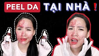 PEEL DA TẠI NHÀ? Serum ĐAU ĐỚN | CHỌN The Ordinary hay Red Peel Tingle Serum?