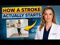 This Is How a Stroke Starts: 5 Warning Signs You Ignore Every Day