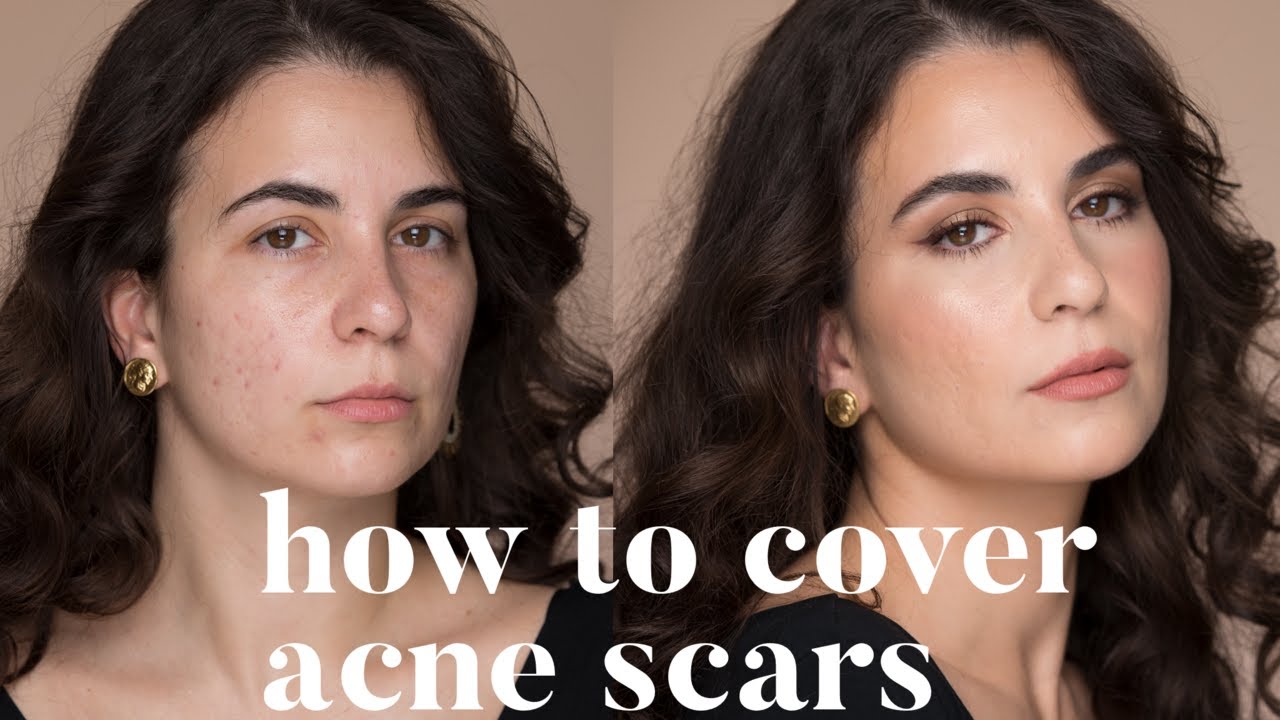 HOW TO COVER ACNE SCARS | ALI ANDREEA