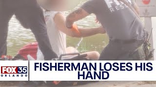 Gator takes off with man's hand during attack in Florida 55+ community
