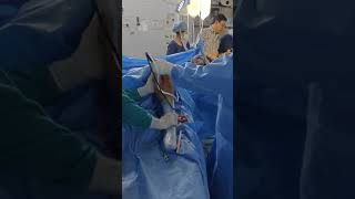 Fontierz Arthro shaver system in clinical surgery