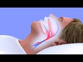 How to Stop Snoring | Best Snoring Solution That Actually Works! Mp3 Song