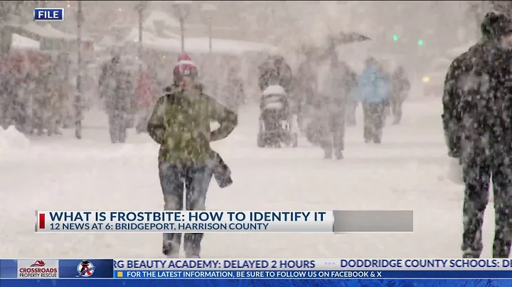 What is frostbite and how can you identify it?