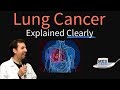 Lung Cancer Explained Clearly by MedCram.com