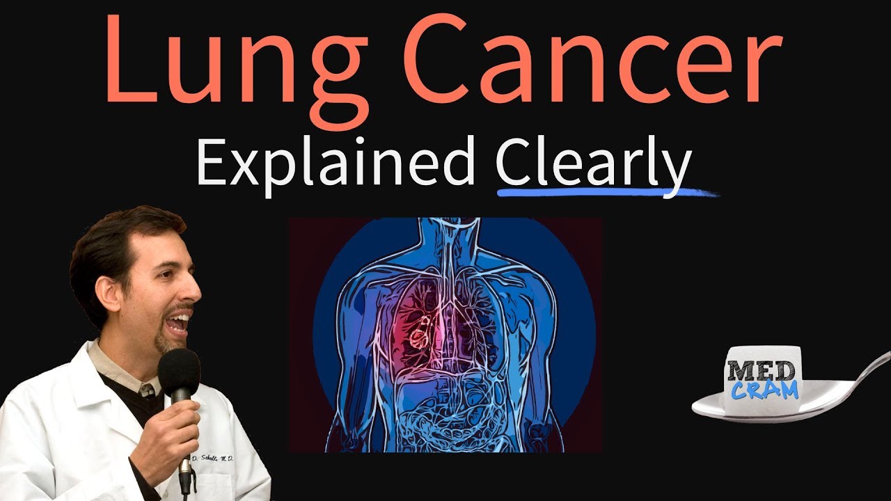 Lung Cancer Explained Clearly by MedCram.com