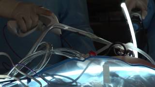 Sibley Memorial Hospital - General Surgery